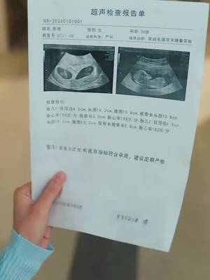 Sistem Bayi Kembar di Kandunganku